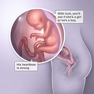 Saptamana 20 de sarcina